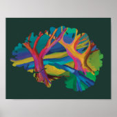 Forest brain-poster poster (Voorkant)