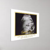 Foto 1e Vaderdag voor Ultrasound Folie Afdrukken (Laagn)