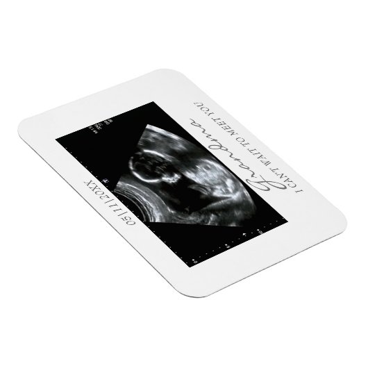 Foto Magnet Ultrasound Gifts for Grandma Sonogram Magneet (Rechterzijde)