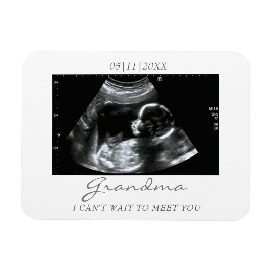 Foto Magnet Ultrasound Gifts for Grandma Sonogram Magneet (Horizontaal)