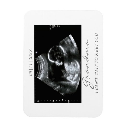 Foto Magnet Ultrasound Gifts for Grandma Sonogram Magneet (Verticaal)