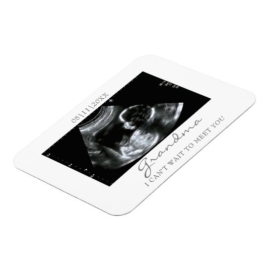 Foto Magnet Ultrasound Gifts for Grandma Sonogram Magneet (Linkerzijde)