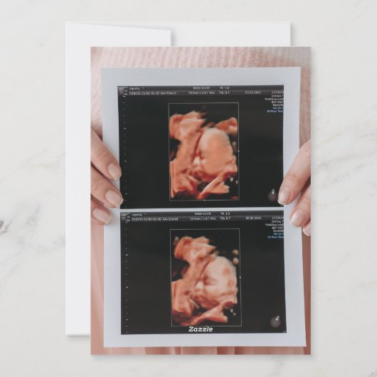 Foto Ultrasound Kerstmis Zwangerschap aankondiging (Achterkant)