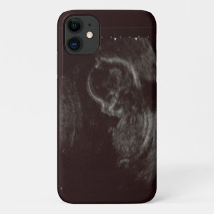 Foto van je baby's Case-Mate iPhone case
