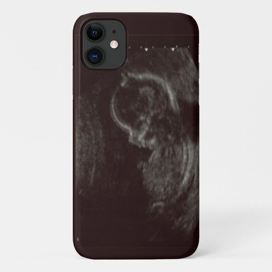 Foto van je baby's Case-Mate iPhone case (Achterkant)
