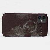 Foto van je baby's Case-Mate iPhone case (Achterkant (horizontaal))