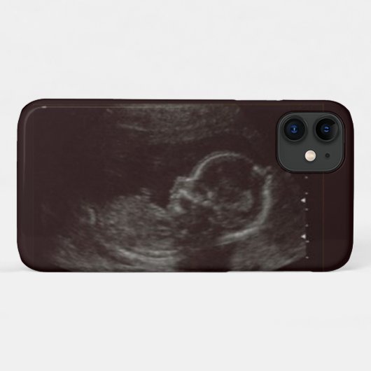 Foto van je baby's Case-Mate iPhone case (Achterkant (horizontaal))