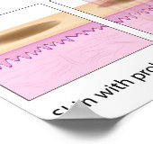 Fractionele laserhuid Poster herrijzen (Hoek)