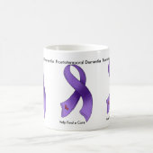 Frontotemporal Dementia vind een echte Mok (Center)