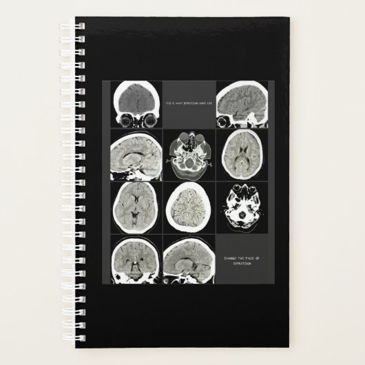 FullCTScan_thisis hoe depressie eruit ziet Planner (Voorkant)