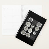FullCTScan_thisis hoe depressie eruit ziet Planner (Display)
