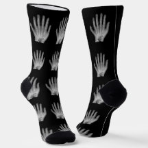 Fun Polydactyl Handradiograaf