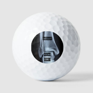 Funny Broken Fibula Xray "Pauze tijd" Golfballen
