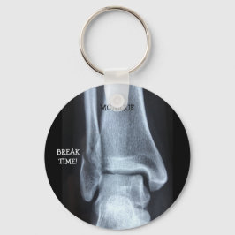 Funny Broken Fibula Xray "Pauze tijd" Sleutelhanger