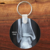 Funny Broken Fibula Xray "Pauze tijd" Sleutelhanger (Voorkant)