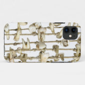 Funny Dental Photography Extracted Teeth Dentist Case-Mate iPhone Case (Achterkant (horizontaal))