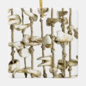 Funny Dental Photography Extracted Teeth Dentist Keramisch Ornament (Voorkant)