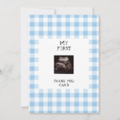 Funny Ultrasound Blue Baby shower dank u Kaart (Voorkant)