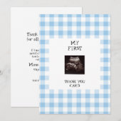 Funny Ultrasound Blue Baby shower dank u Kaart (Voorkant / Achterkant)