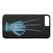 Funny Wolverine Blades Hand Xray Case-Mate iPhone Case (Achterkant (Horizontaal))