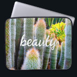 Fuzzy Groene Cactussen Succulent Foto Schoonheid S Laptop Sleeve<br><div class="desc">Cactussen gedijen onder de zwaarste woestijnomstandigheden. Droom van zonnige dagen en de schoonheid van een zomertuin wanneer u deze prachtige fotografie neopreen laptop sleeve gebruikt. Deze laptophoes is verkrijgbaar in drie formaten: 15, 13 en 10 inch. Maakt een geweldig cadeau voor iemand speciaal! U kunt deze neopreen laptophoes eenvoudig personaliseren...</div>