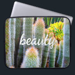 Fuzzy Groene Cactussen Succulent Foto Schoonheid S Laptop Sleeve<br><div class="desc">Cactussen gedijen onder de zwaarste woestijnomstandigheden. Droom van zonnige dagen en de schoonheid van een zomertuin wanneer u deze prachtige fotografie neopreen laptop sleeve gebruikt. Deze laptophoes is verkrijgbaar in drie formaten: 15, 13 en 10 inch. Maakt een geweldig cadeau voor iemand speciaal! U kunt deze neopreen laptophoes eenvoudig personaliseren...</div>