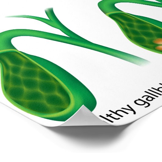 Galstenen en lever Poster (Hoek)