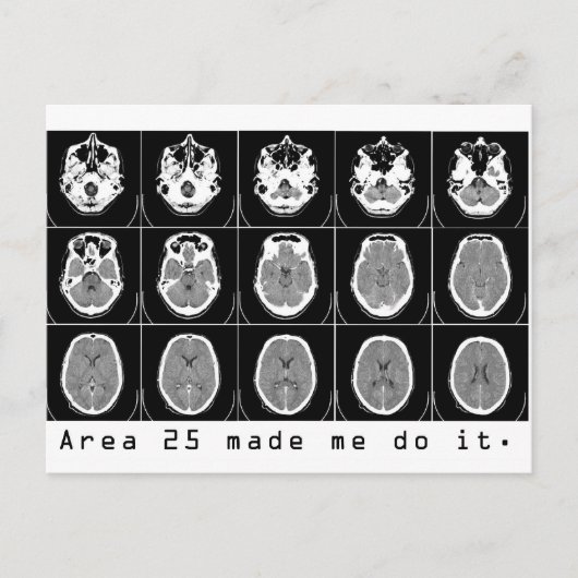 Gebied 25 deed me dat. briefkaart (Voorkant)