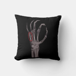 Gebroken Botten Handen Skelet Röntgenfoto T-shirt Kussen