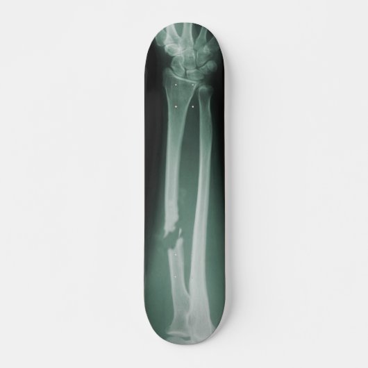 Gebroken Botten Skateboard (Voorkant)