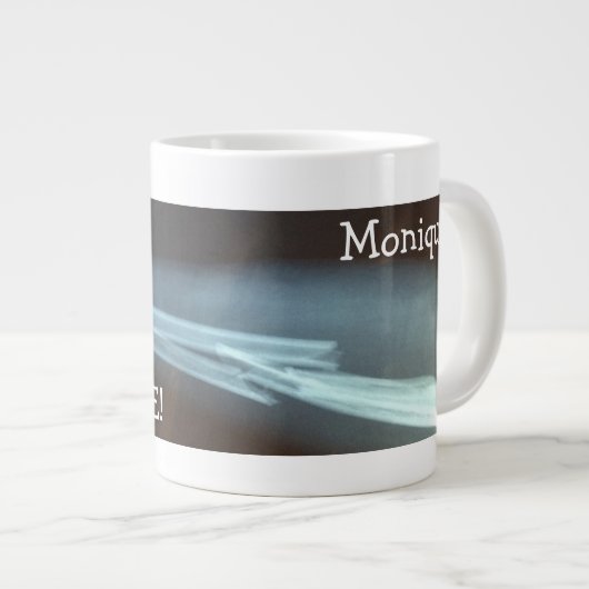 Gebroken spaakbeen en ellepijl "Pauze tijd" Grote Koffiekop (Voorkant rechts)