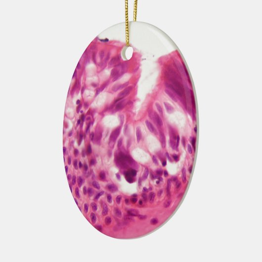 Gecilieerd epitheel onder de microscoop. keramisch ornament (Links)