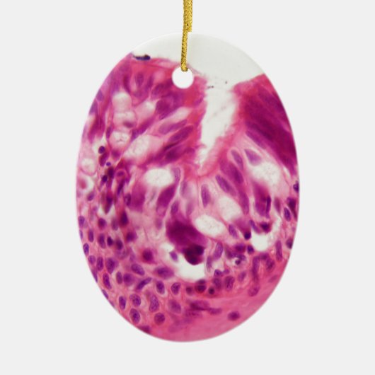 Gecilieerd epitheel onder de microscoop. keramisch ornament (Voorkant)