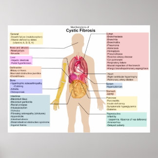 Gedetailleerde grafiek van de symptomen van cystis poster