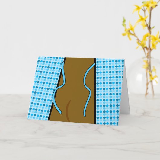 Gefeliciteerd met Colonoscopie, Open Gown Kaart (Gele Bloem)