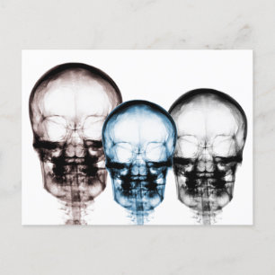 Gemengde kleuren X-Ray Vision Skeleton Skulls Briefkaart