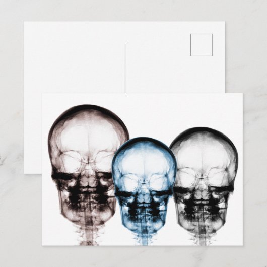 Gemengde kleuren X-Ray Vision Skeleton Skulls Briefkaart (Voorkant / Achterkant)
