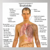 General Symtoms Chart of a Snakebeet Poisoning Poster (Voorkant)