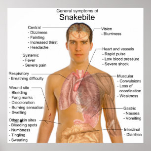 General Symtoms Chart of a Snakebeet Poisoning Poster