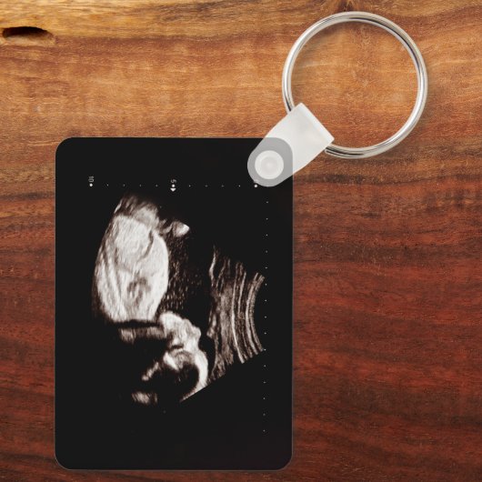 Gepersonaliseerde Baby-echo Sleutelhanger (Achterkant)