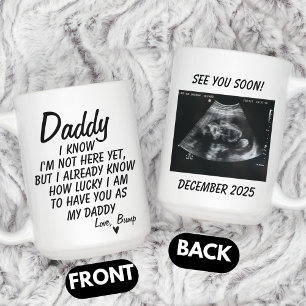 Gepersonaliseerde echografie foto, echografie foto koffiemok