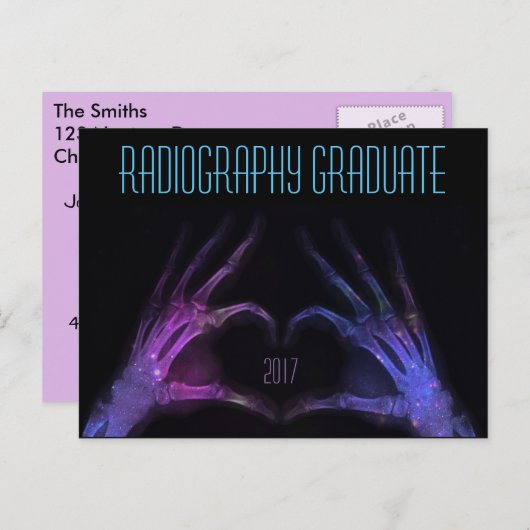 Gepersonaliseerde "Radiography Afstuderen" Xray Fi Aankondigingskaart (Voorkant / Achterkant)