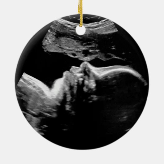 Gepersonaliseerde Ultrasound 1st Christmas Keramisch Ornament (Achterkant)