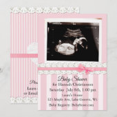 Gepersonaliseerde Ultrasound Baby Shower Uitnodigi Kaart (Voorkant / Achterkant)