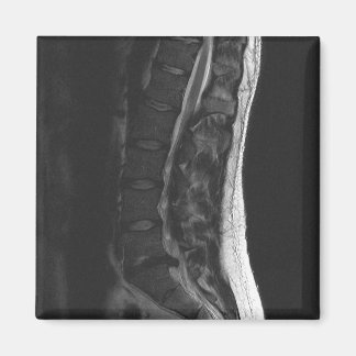 Geruptureerde schijfmagneet magneet
