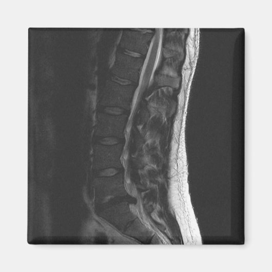 Geruptureerde schijfmagneet magneet (Voorkant)