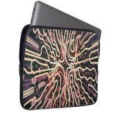 Gestreepte textuur laptop sleeve (Voorkant Rechts)