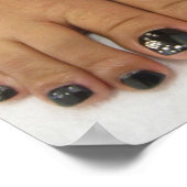 Gevlekte nagels poster (Hoek)