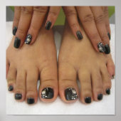 Gevlekte nagels poster (Voorkant)