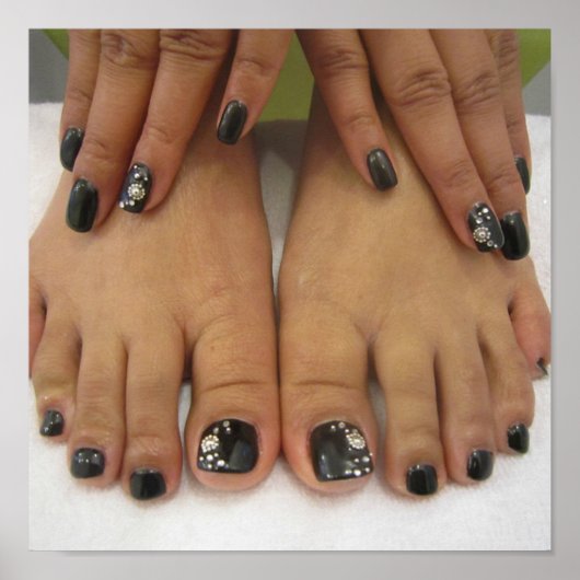 Gevlekte nagels poster (Voorkant)